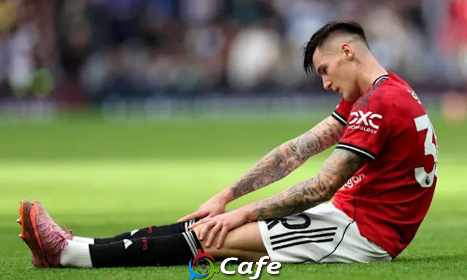 MU vẫn chưa thể dùng Sesko vì lý do đặc biệt