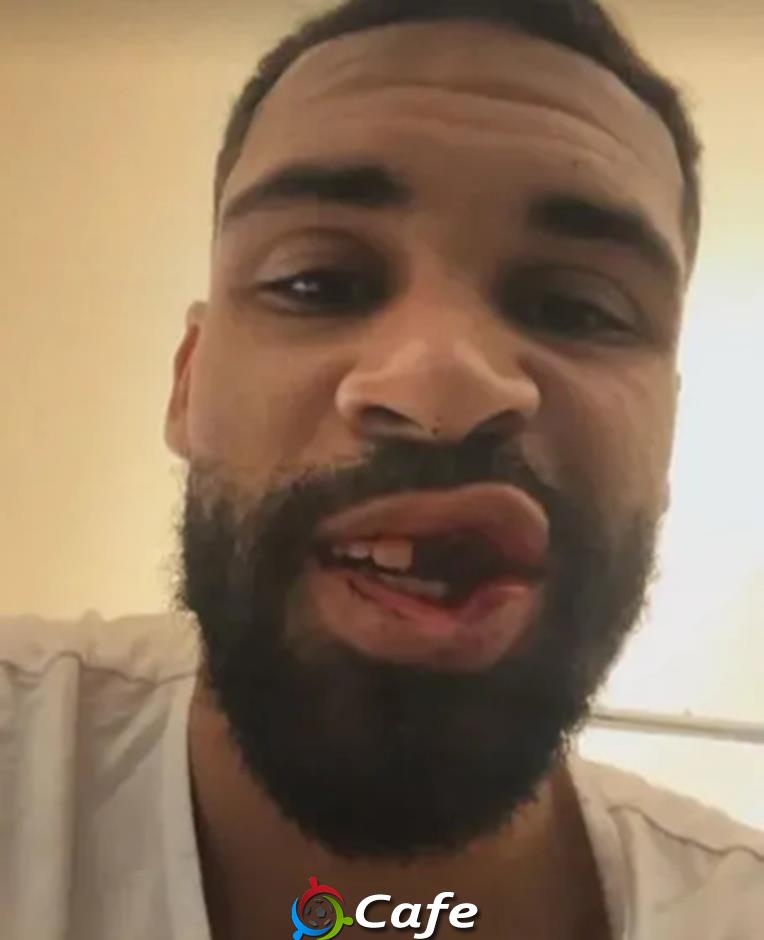 Ruben Loftus-Cheek chấn thương kinh hoàng sau trận Milan đấu Parma
